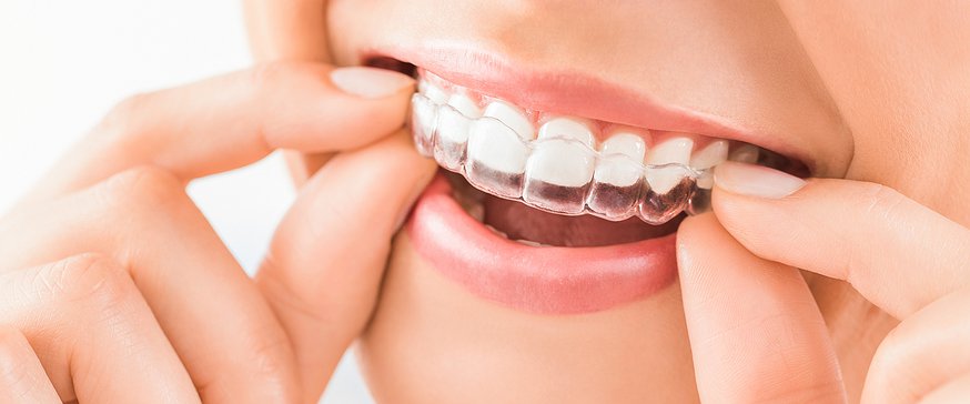 Invisalign treatment in Madipakkam